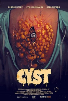 CYST บรรยายไทยแปล